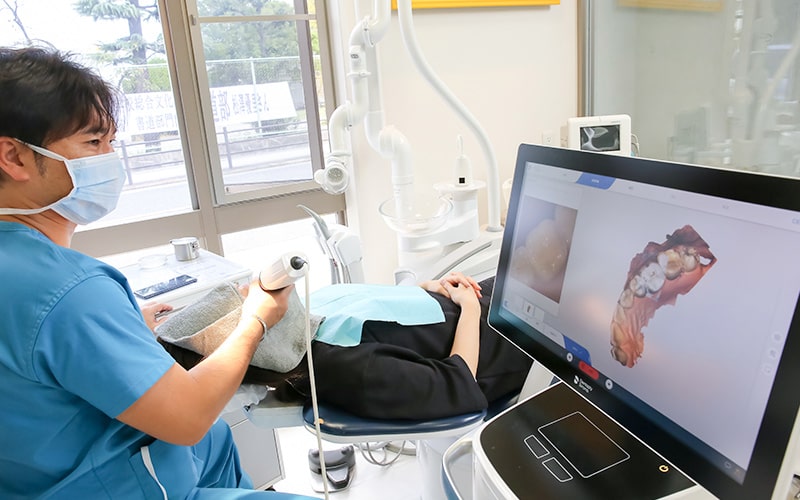 清誠歯科のセレックの治療の流れ｜3D光学カメラを使用して口腔内、削った歯を撮影