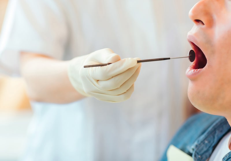 歯周病の検査・治療メニュー