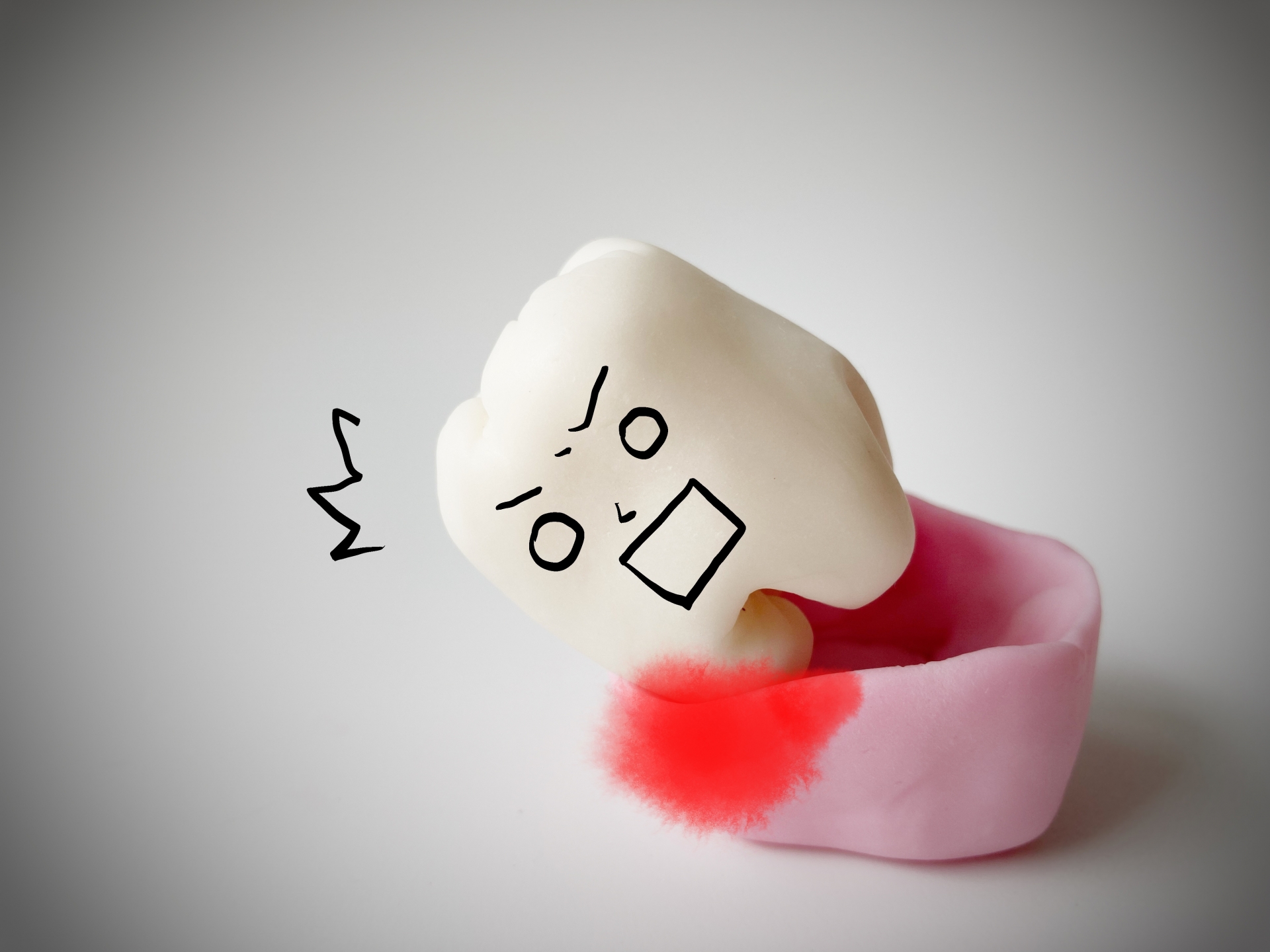 折れ た 歯 放置